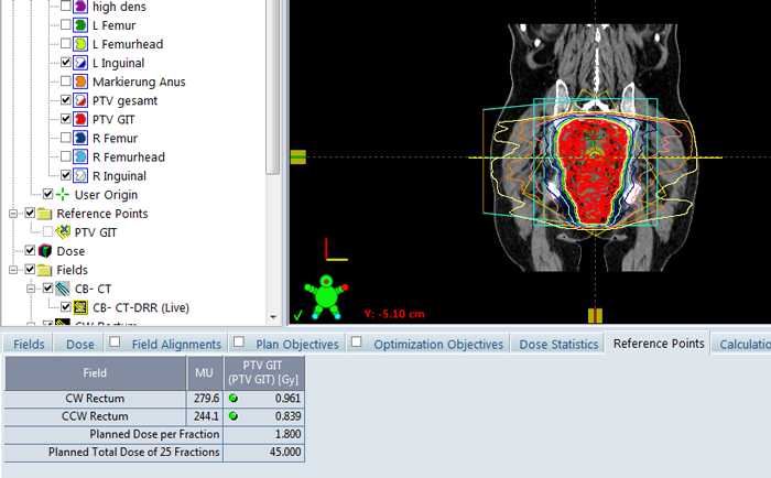 External Beam Planning News