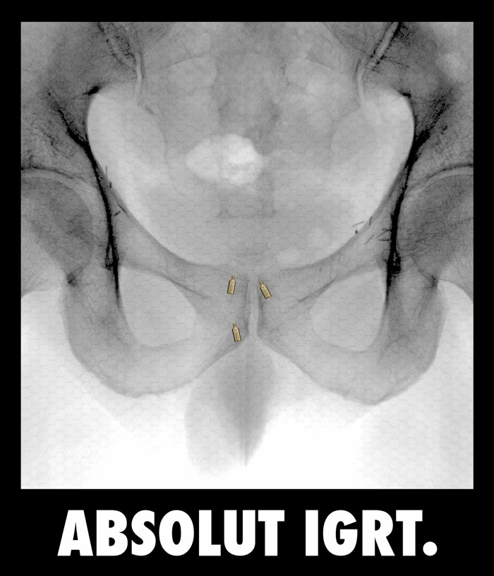 Absolut IGRT