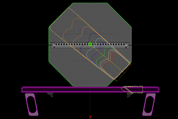 Gantry 130° 6MV field in Eclipse