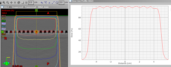 AAA 8.6.14 calculation with grid 2.5 mm