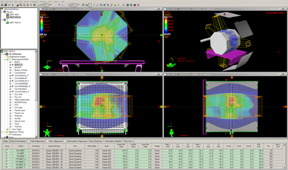 Head and neck IMRT plan