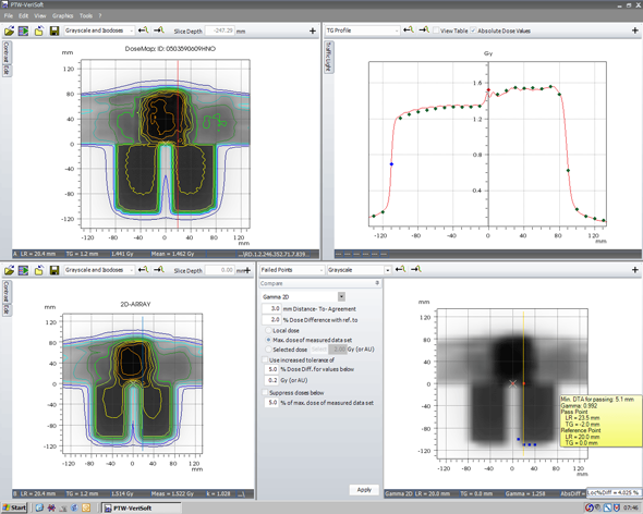 Head and neck IMRT plan with abutting static supra field