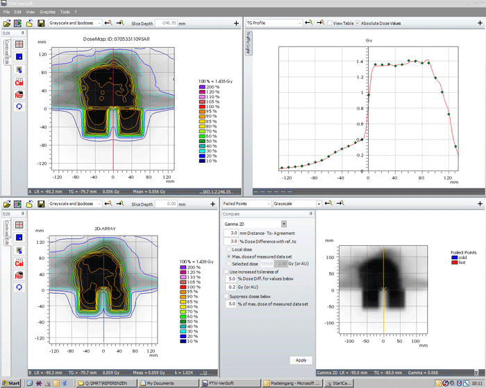 9 field IMRT plan verified with masked Octavius