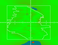 out-of-field dose example