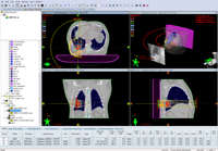 First clinical case with Gating at KFJ 