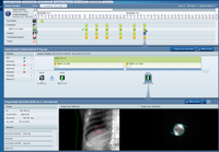 First clinical case with Gating at KFJ. RT Summary of session 6. 