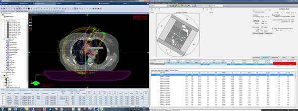 VMAT calculation with DIAMOND