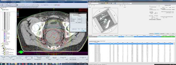 VMAT calculation with DIAMOND