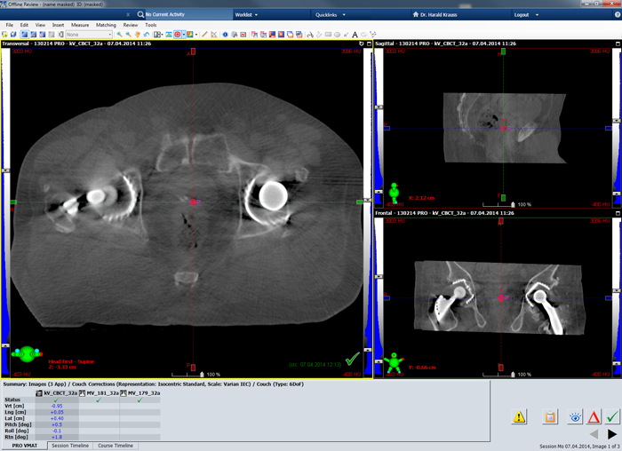 CBCT session 32