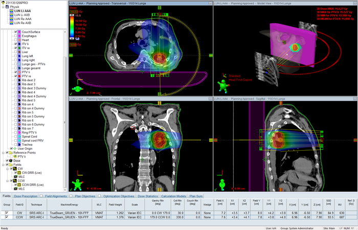 SBRT plan left lung