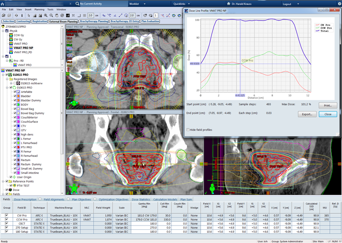 Typical prostate plan with two arcs