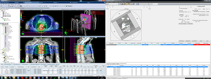 Verification of plan with lung not segmented