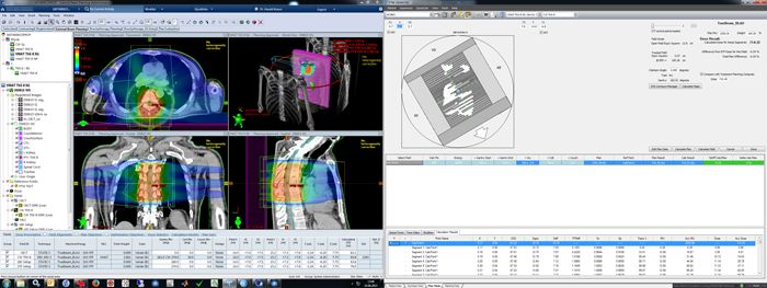 Verification of plan without heterogeneity correction