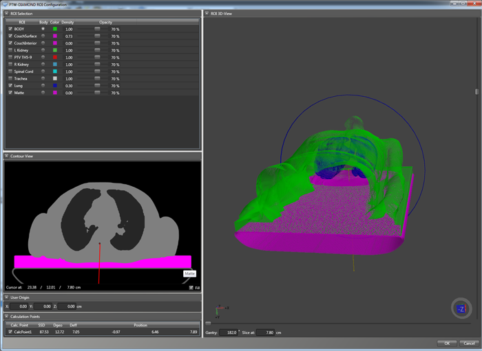 ROI Manager with two additional low density structures (Lung and Matte)