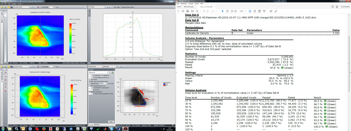 Analysis of head and neck plan, Acuros calculation with 1.5 mm grid