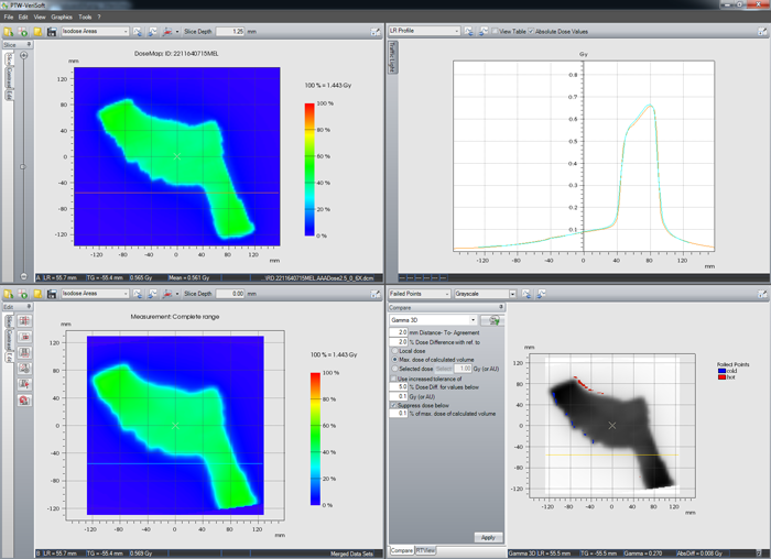 IMRT at gantry 0° coronal plane off-axis profile