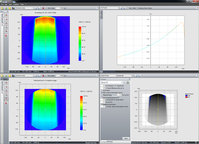 IMRT at gantry 0° transversal plane