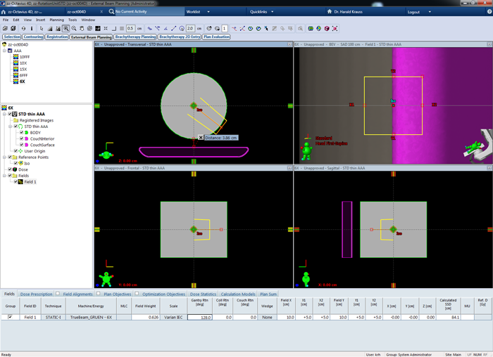 Start of shadowing in Eclipse with corrected couch position