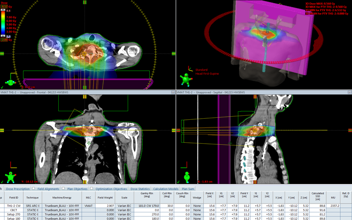 Clinical plan 8Gy to Th 1-2