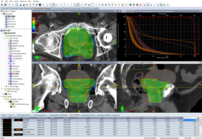 Plan optimized with PO15.0