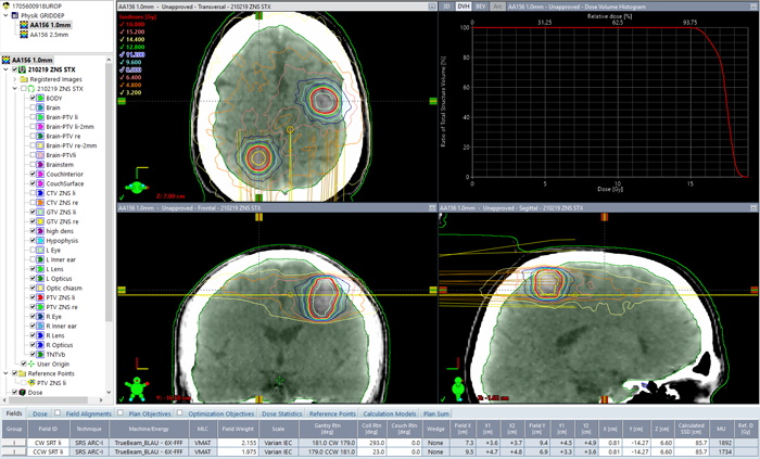 Clinical plan with two PTVs