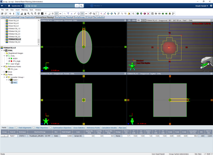 Static field PDD comparison