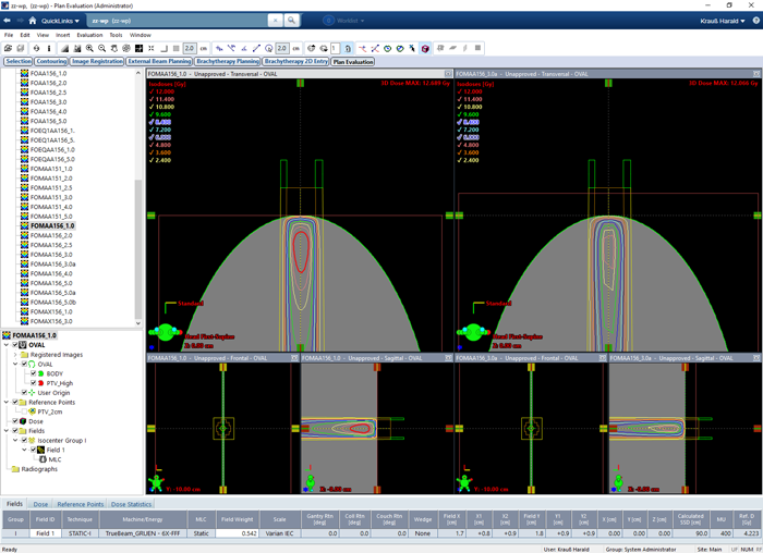 Static field PDD comparison