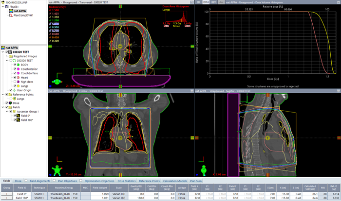 AP/PA treatment, 15 MV