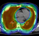 Lung irradiation