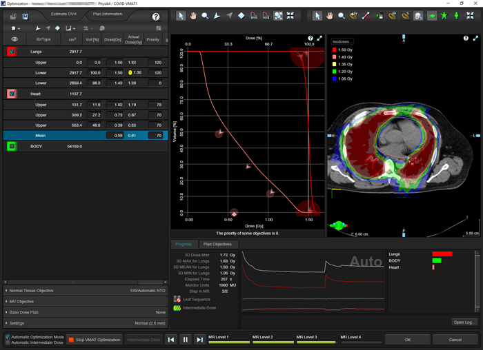 VMAT optimization of COVID-19 planning study