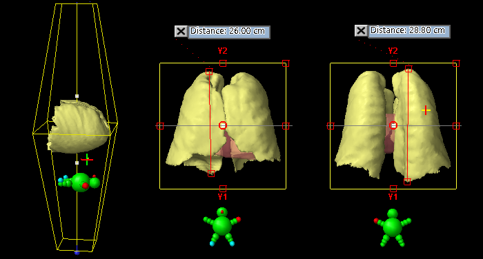 Isocenter distances