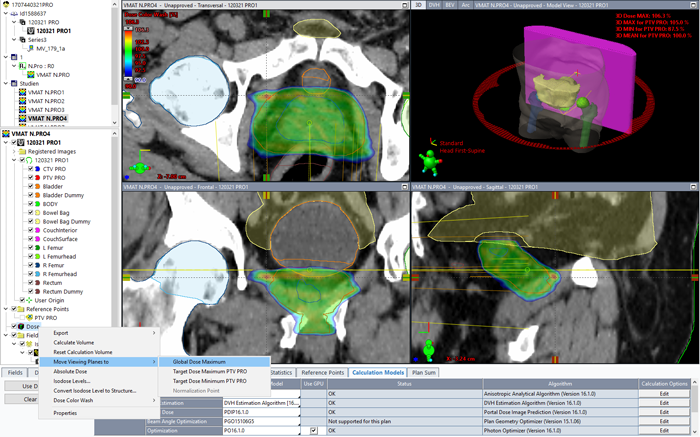 NS_Control ring structure to avoid hotspots near the prostate PTV