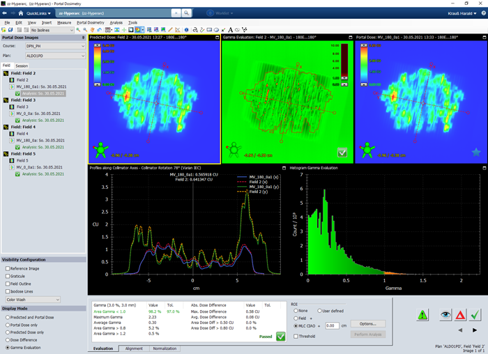 Varian Portal Dosimetry