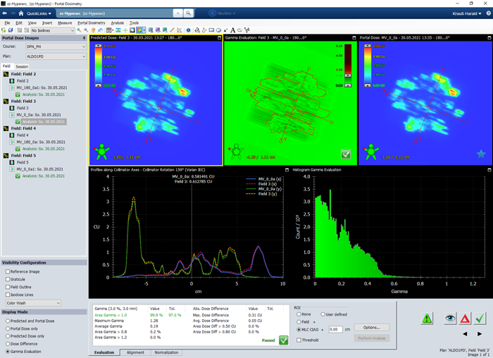 Varian Portal Dosimetry