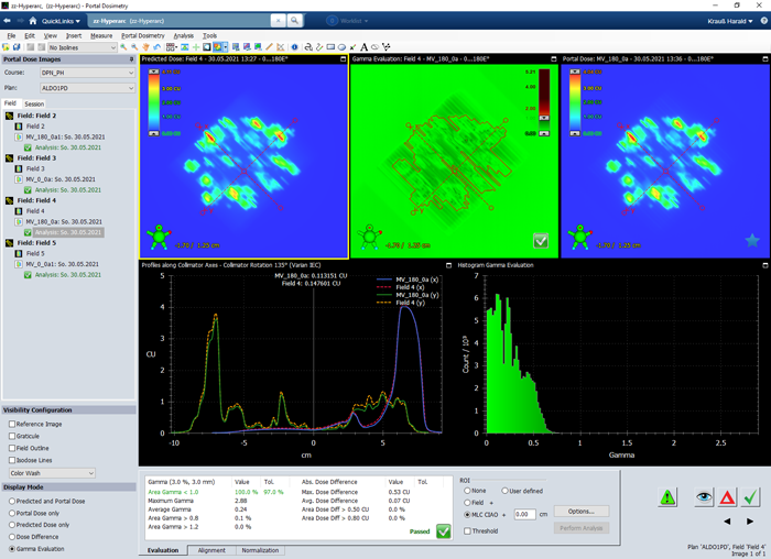 Varian Portal Dosimetry