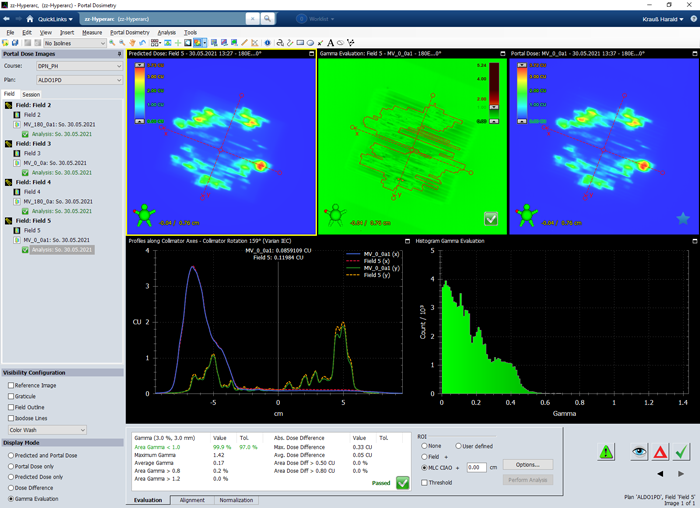 Varian Portal Dosimetry