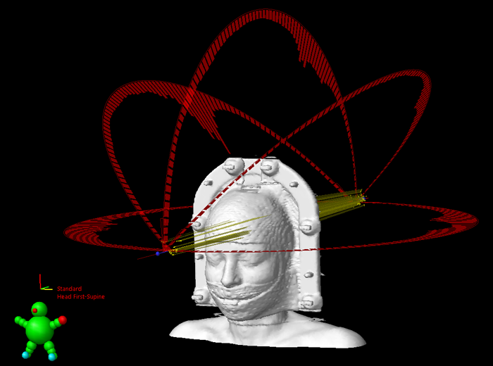 Typical Arc Arrangement