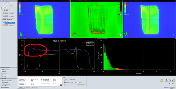 Portal Dosimetry