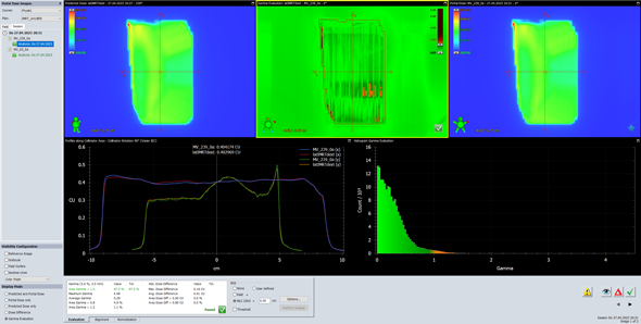 Portal Dosimetry