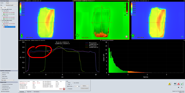 Portal Dosimetry