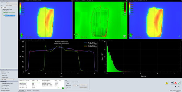 Portal Dosimetry