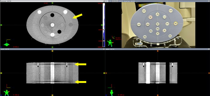 CBCT Replanning