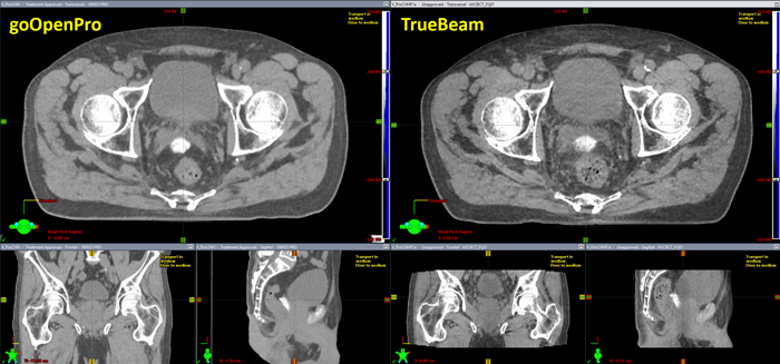 CBCT Replanning