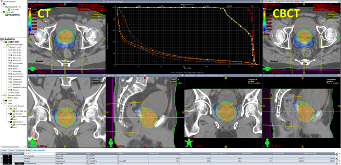 CBCT Replanning