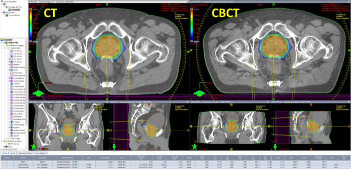 CBCT Replanning