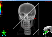 DRR showing a copper wire from the 403 overlay running diagonally through the image.