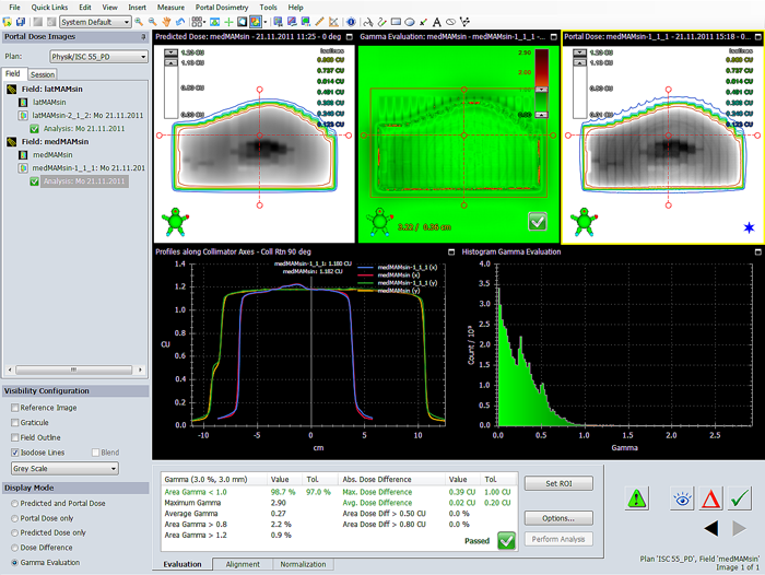 Irregular surface compensation, medial field