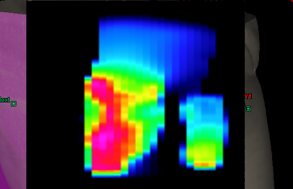 Optimal fluence 320° field