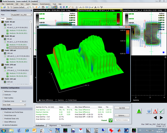 PD 3D dose difference