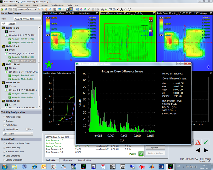 PD arbitrary histo